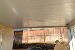Alumawood Aluminum Patio Cover in Castaic // Santa Clarita