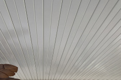 Alumawood Newport Patio Cover Santa Clarita